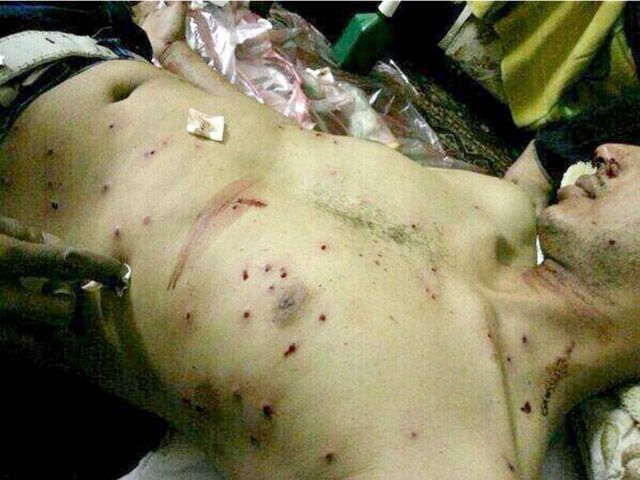 صورة نشرتها «الوفاق» لأحد المصابين جراء الأحداث الأخيرة
