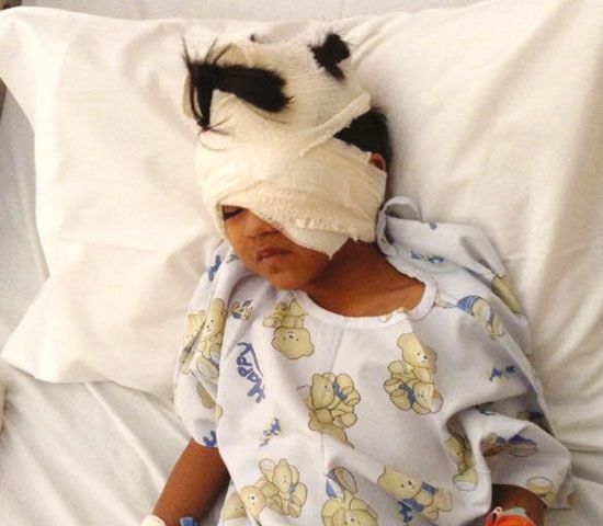 الطفل أحمد بعد إجراء العملية الجراحية له