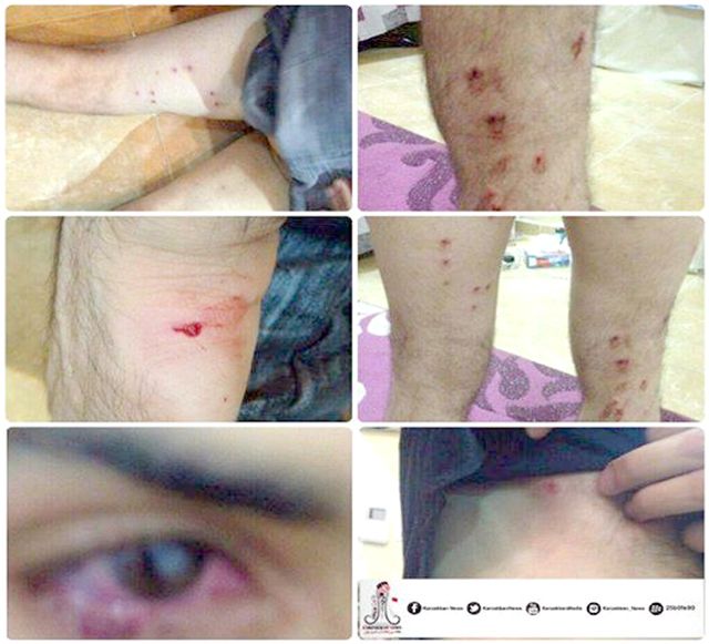 صورة عممتها «الوفاق» تظهر إصابات بسلاح الشوزن
