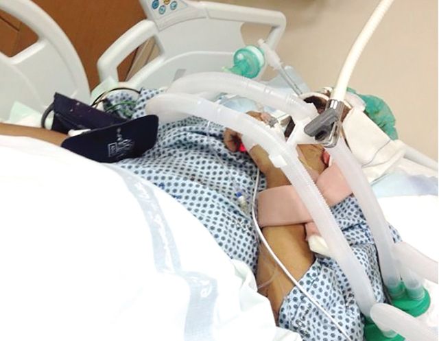 المصاب عبدالله ياسين يرقد في غرفة العناية المركزة