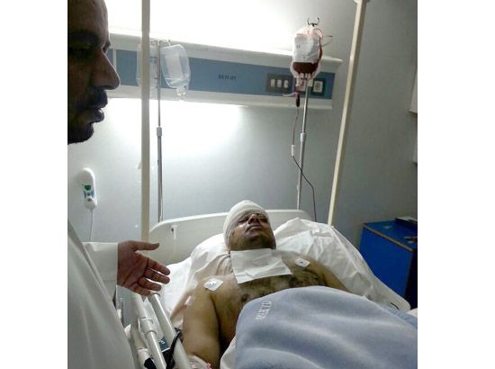 المصاب عبدالجبار جواد سرحان خلال تواجده في مستشفى الدمام مساء أمس