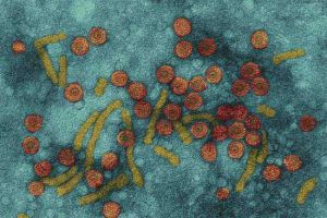 دراسة سعودية: تجاهل فيروس 'جي' قد يسبب سرطان الكبد