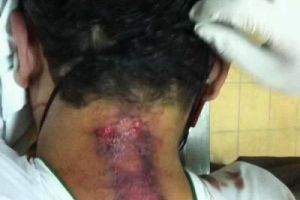 وزارة حقوق الانسان: الجهات المختصة ستعمل على جلب الذين تسببوا في وفاة على الشيخ