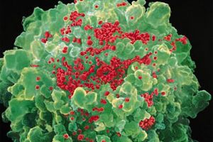 علماء ينجحون في 'نزع سلاح' فيروس الايدز