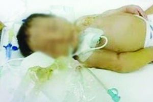 أب هندي يضرب ابنته الرضيعة حتى الموت