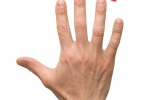 علماء يعيدون الإحساس ليد رجل سبعيني مصاب بشلل نصفي