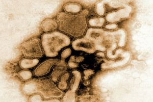 دراسة:انتشار انفلونزا الخنازير عام 2009 أودى بحياة عدد أكبر مما أعلن 