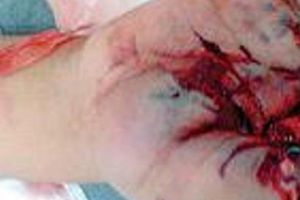 مسلحون يخطفون جنديا يمنيا ويقطعون اصابع يده