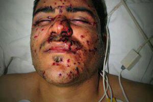 براءة جعفر سلمان وعلي حميدان من تهمتي التجمهر ورشق الشرطة بالحجارة