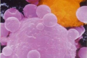 دراسة جديدة: كأس خمر واحدة يوميا تزيد خطر الإصابة بالسرطان 