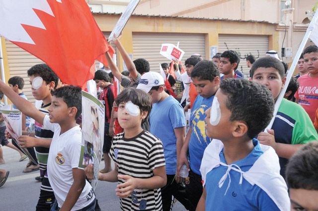 أطفال يضعون ضمادة على أعينهم في إشارة إلى فقدان الطفل النهام إحدى عينيه