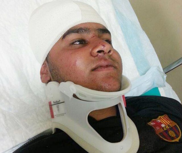 أحد المصابين وهو لاعب اليد نضال يوسف