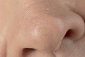 الرياضة .. مفيدة للأنف أيضاً