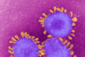 'كورونا'.. التاج الذي قتل 170  سعودياً