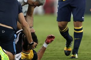 كسر في انف ماندزوكيتش يبعده موقتا عن اتلتيكو مدريد