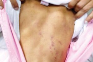 'حقوق الإنسان السعودية' ترصد 181 قضية عنف ضد الأطفال