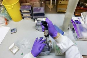 الكشف عن عقار جديد مضاد لفيروس ايبولا