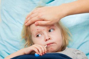 ألمانيا: الحكم على عالم أحياء بدفع 100 ألف يورو إثر تحدي حول مرض الحصبة