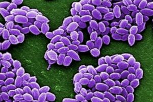 الجيش الأمريكي يبعث بالخطأ بكتيريا الجمرة الخبيثة حية إلى مختبرات في أنحاء أمريكا