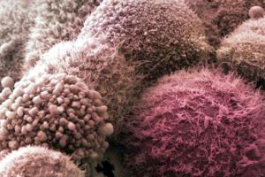 علماء: اختبار منخفض التكاليف لتشخيص سرطان البنكرياس