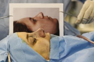 شاهد صوراً لعمليات تجميل الأنف في العاصمة الإيرانية طهران