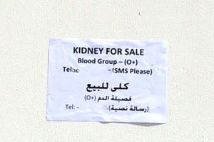 بنغالي مقيم يعرض كليته للبيع بحثاً عن لقمة العيش