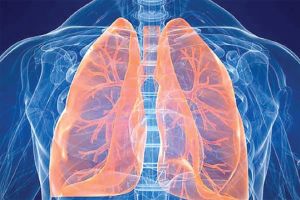 علاج الانسداد الرئوي ممكن بدون استئصال الرئة