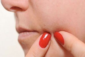 دراسة تحمّل «فيتامين بي 12» مسئولية زيادة «حَب الشباب»