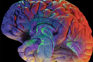 أدمغة الرجل والنساء... هل هناك فروق جوهرية؟