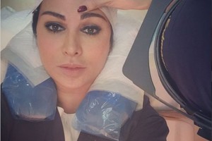 جويل مردينيان تزرع 700 شعرة في حاجبيها