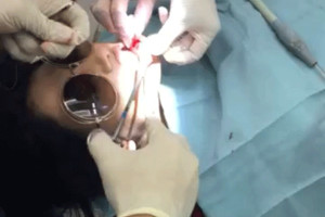 بالصور... شيلاء سبت تجري عملية جراحية وتلبس النظارات الشمسية