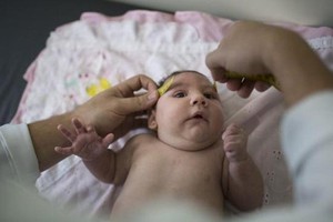 فنلندا تعلن اكتشاف حالتي اصابة بفيروس زيكا