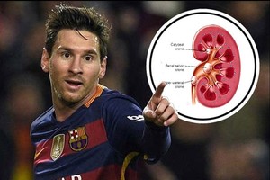 ميسي جاهز لمواجهة سيلتا فيغو بعد إجراءه عملية 'الكلية'