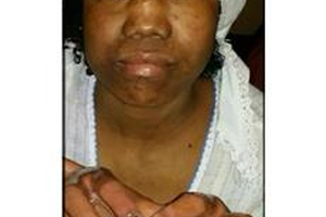 الكويت: عاملة منزل تفقد بصرها إثر تعذيبها من طبيبة... والمحكمة تقضي بحبسها 3 سنوات