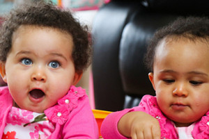 توأمان إحداهما بيضاء والأخرى سوداء في حالة تعد تمرّداً على الطبيعة البشرية