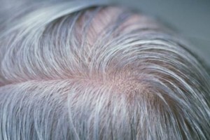 اكتشاف الجين المسئول عن شيب الشعر