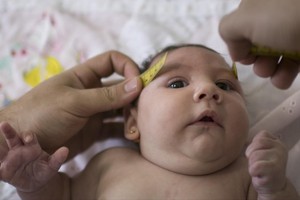 منظمة الصحة تناشد الأعضاء توفير 4 ملايين دولار لمكافحة فيروس زيكا