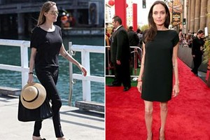 ما هو مرض «انجلينا جولي» الخطير الذي أوصلها لوزن 35 كيلو فقط