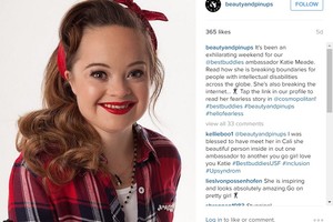 بالصور... فتاة مصابة بمتلازمة داون وجه دعائي لشركة مستحضرات تجميل