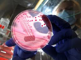 تفشي بكتيريا 'اليزابيث كنجيا' في بولاية ايلينوي الأميركية