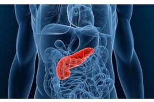 جهاز جديد يُزرع داخل البنكرياس للقضاء على السرطان