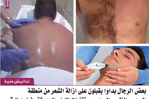 بعض الرجال يزيلون الشعر من منطقة الصدر والظهر والوجه عبر تقنيات الليزر الحديثة. فما رأيك؟