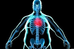 دراسة: السمنة 'أقل إضراراً بالصحة' عما كان يعتقد في السابق