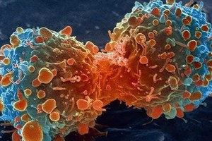 12 خطوة لتجنب الإصابة بالسرطان