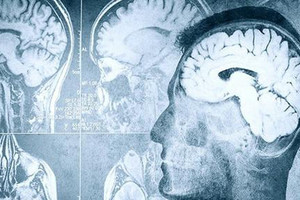 العلماء يؤكدون وجود صلة بين اضطرابات النوم والذاكرة