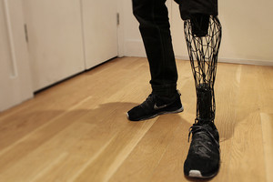 دبي تنتج أطرافاً صناعية بتكلفة أقل من 400 درهم عام 2025