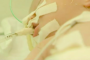 إنقاذ جنين بعد عقم 54 عاماً