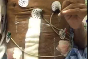 'صحة حائل' السعودية تعتذر عن نسيان مقص ببطن مريض.. و'هاكرز' يخترق موقع المستشفى لإيصال رسالة!