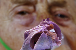 الهواء الملوث يزيد خطر الإصابة بأمراض القلب