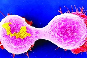 التحليل الجيني يكشف عن 11 نوعاً لسرطان الدم